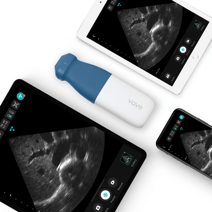 POCUS Essential Pro - Vave Phased Probe with POCUS Fundamentals Certificate - Vave Health