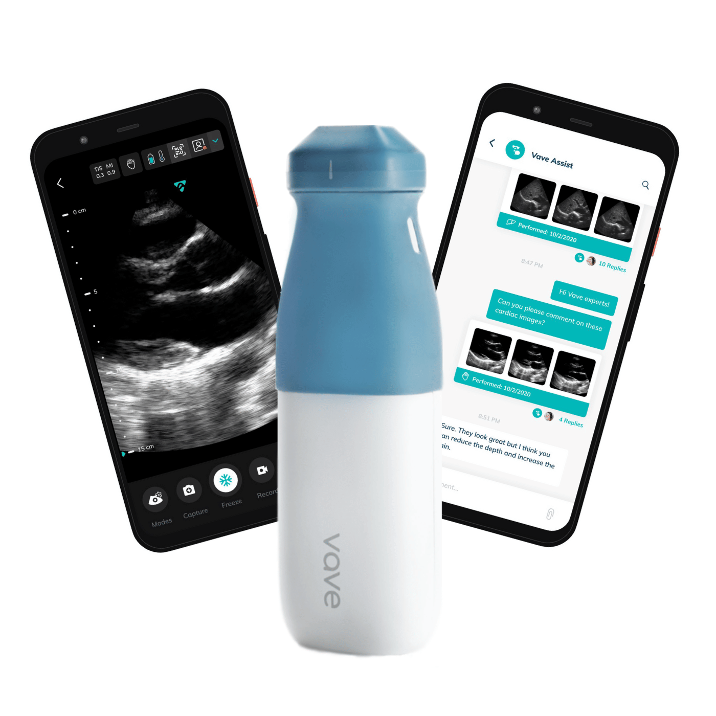 Vave Phased-Array Wireless Ultrasound - Vave Health